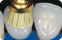 Occlubrush regular cup